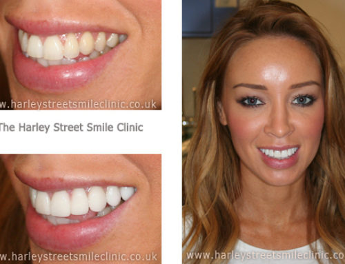 Lauren Pope – TOWIE