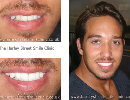 James Lock – TOWIE