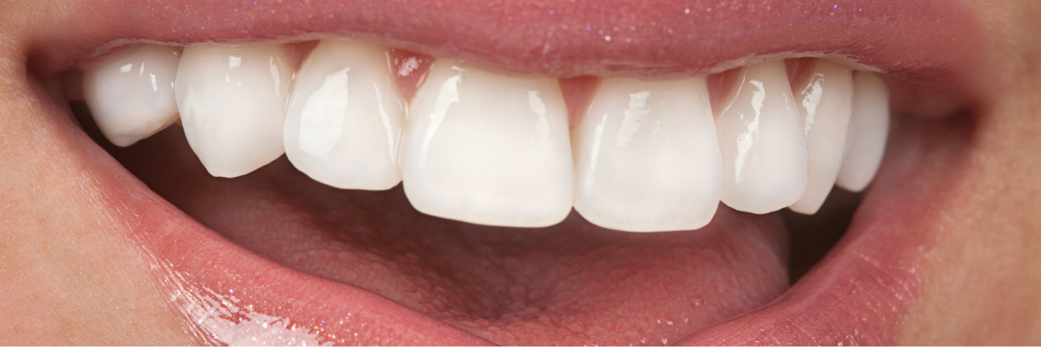 Benefits of Cosmetic Dentistry - Harley St Smile